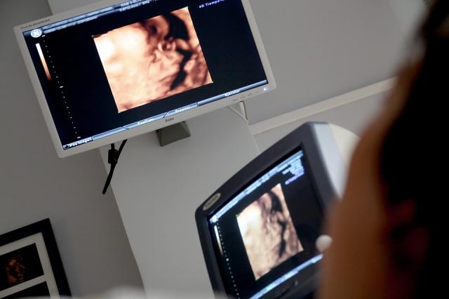 Aprobada una moción de VOX en Pozuelo para crear un 'servicio de información' a embarazadas acerca del aborto