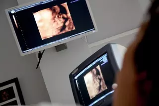 Aprobada una moción de VOX en Pozuelo para crear un 'servicio de información' a embarazadas acerca del aborto