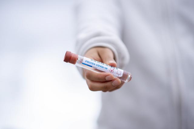 El Ayuntamiento planea realizar test de detección de Coronavirus a todos los vecinos de Pozuelo