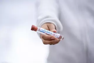 El Ayuntamiento planea realizar test de detección de Coronavirus a todos los vecinos de Pozuelo