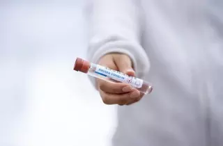 Datos actualizados del número de contagios por Covid19 en Pozuelo de Alarcón