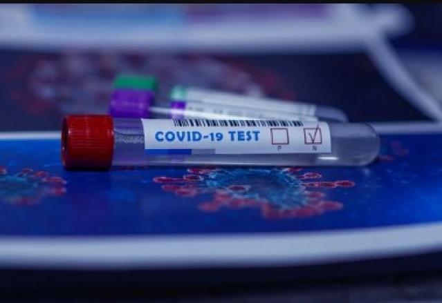 El PSOE de Pozuelo demanda transparencia sobre los test anunciados por la alcaldesa