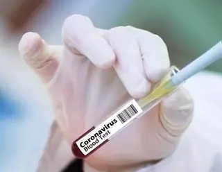 Continúa aumentando el número de casos de coronavirus en Pozuelo de Alarcón