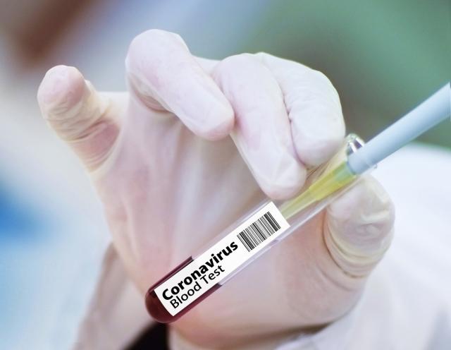 Continúa aumentando el número de casos de coronavirus en Pozuelo de Alarcón