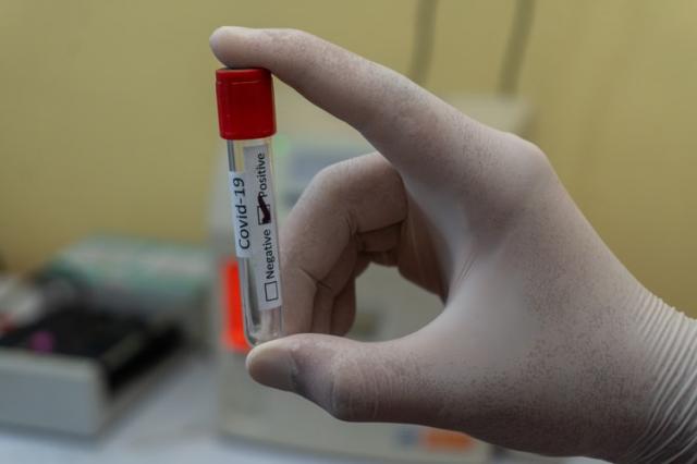 Repunte de la tasa de Covid-19 en Pozuelo