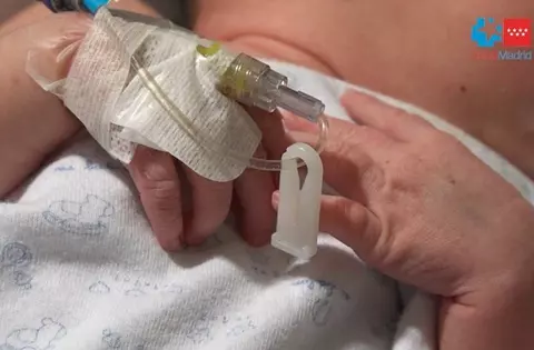 Un hospital madrileño,  pionero en el mundo en realizar a un bebé un trasplante de corazón en asistolia y grupo sanguíneo incompatible