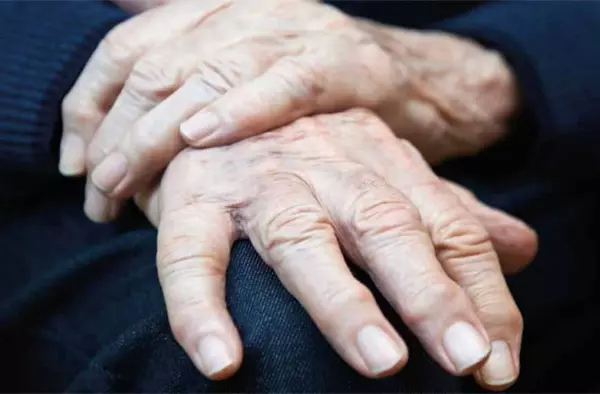 Pozuelo de Alarcón conmemora este miércoles el Día Mundial del Parkinson